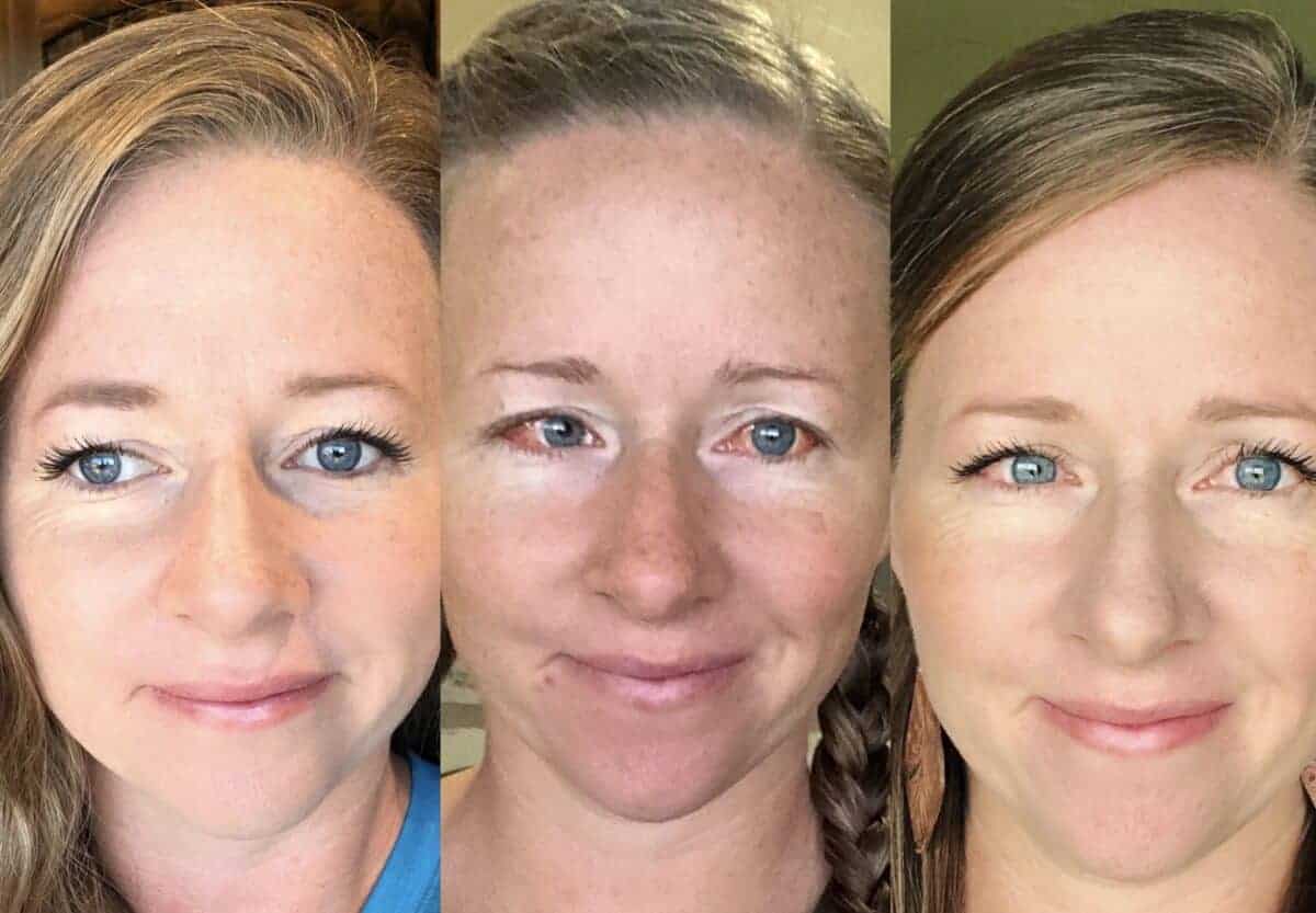 15 Questions To Ask Your Surgeon AFTER Your Strabismus Surgery ...